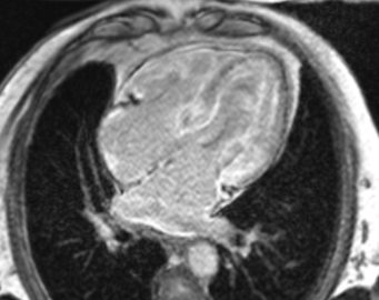 rmn cardiac