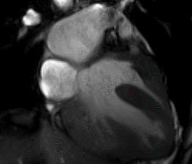 rmn cardiac