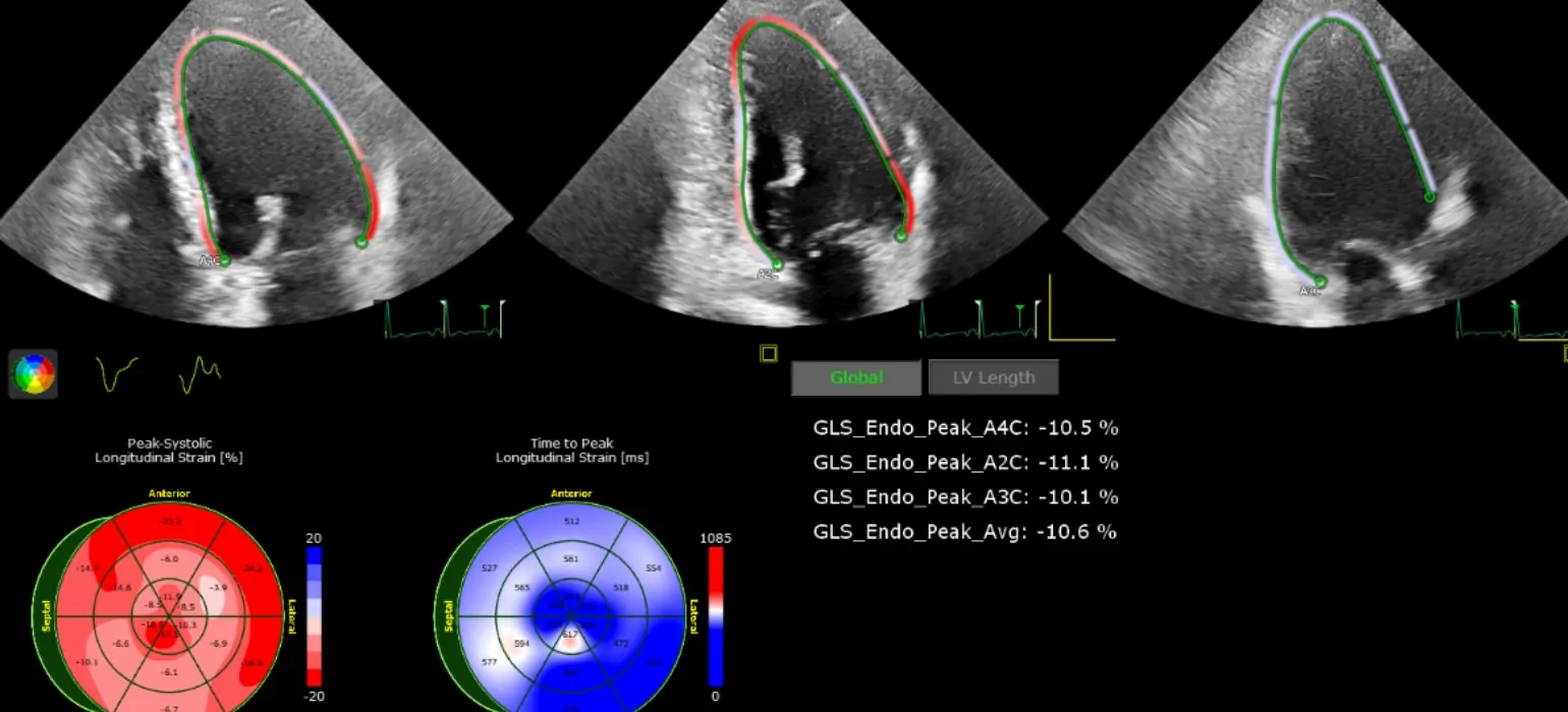 Ecocardiografia - imagistica multimodala cardiovasculara